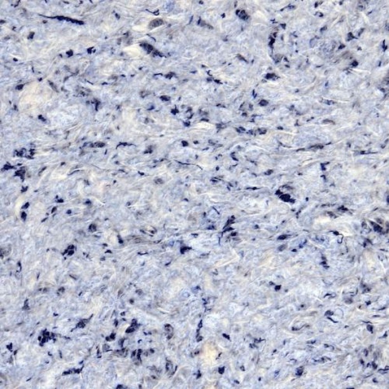 Жидкие обои  Vesta 9, 1 кг